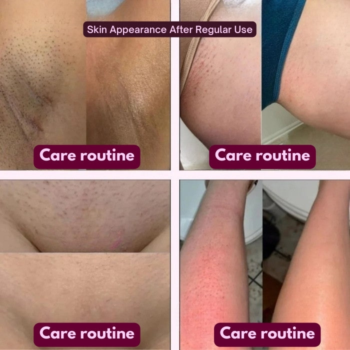 Velmora 2-in-1 Electric Shaver for Sensitive Skin ✨ Pain-Free, Smooth & Irritation-Free Hair Removal 🌸