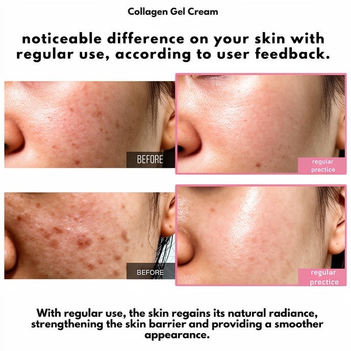 Collagen Jelly Cream | Intense Hydration, Radiant Skin & Smooth Appearance ✨💗